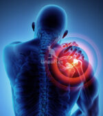 Guanciale Mirror Decontratturante Gel Saponetta - immagine 2